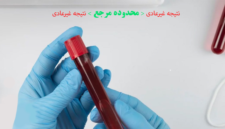 رنج نرمال در آزمایش