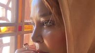 صورت آفتاب خورده بهاره رهنما + عکس