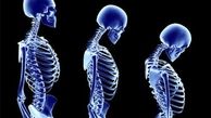 کاهش قد را جدی بگیرید،یک نشانه است! 
