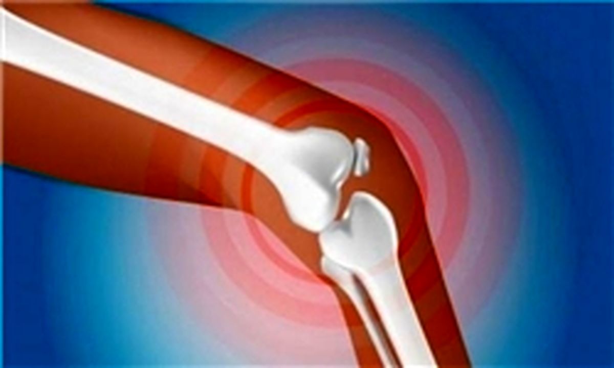 درمان و پیشگیری از پوکی استخوان از طریق نانوفناوری
