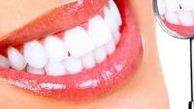 چه راه هایی برای زیباتر شدن دندان ها مناسب است؟
