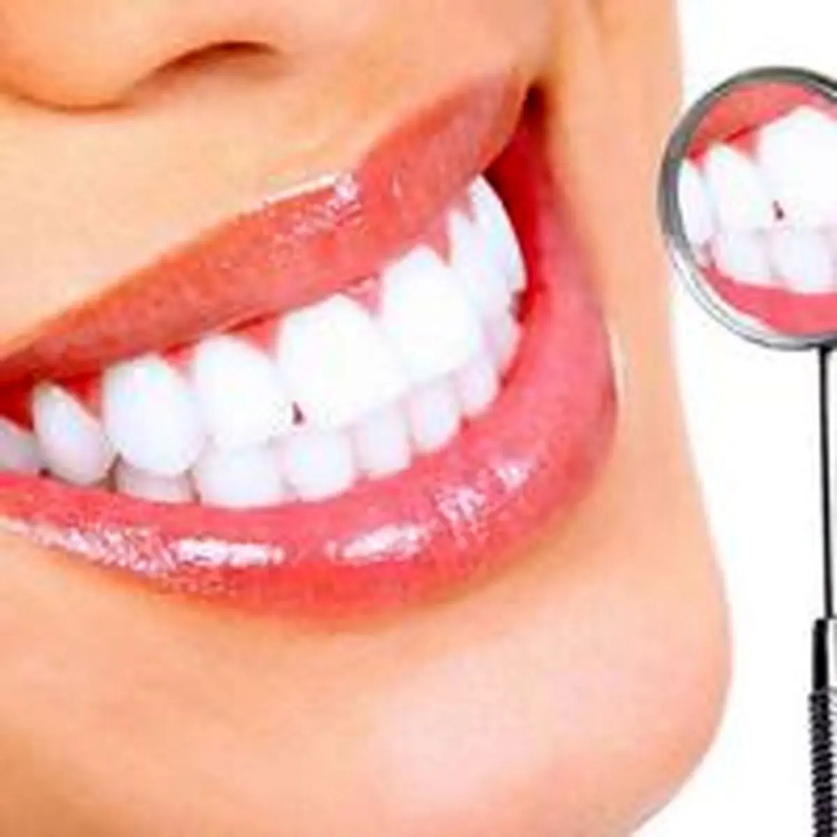 چه راه هایی برای زیباتر شدن دندان ها مناسب است؟