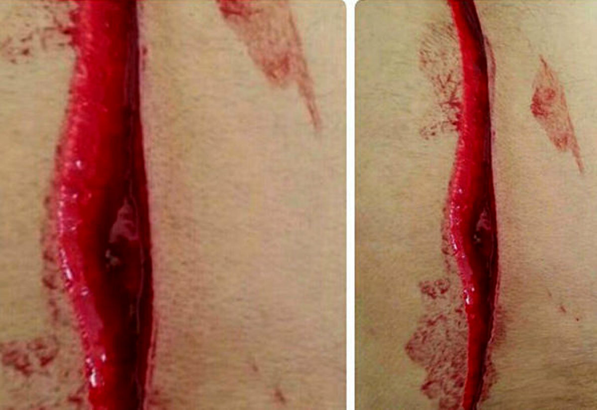حمله خونین دانش آموز هنرستانی به مدیر مدرسه در جیرفت