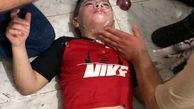 مصدوم شدن ده‌ها فلسطینی بر اثر استنشاق گاز اشک‌آور