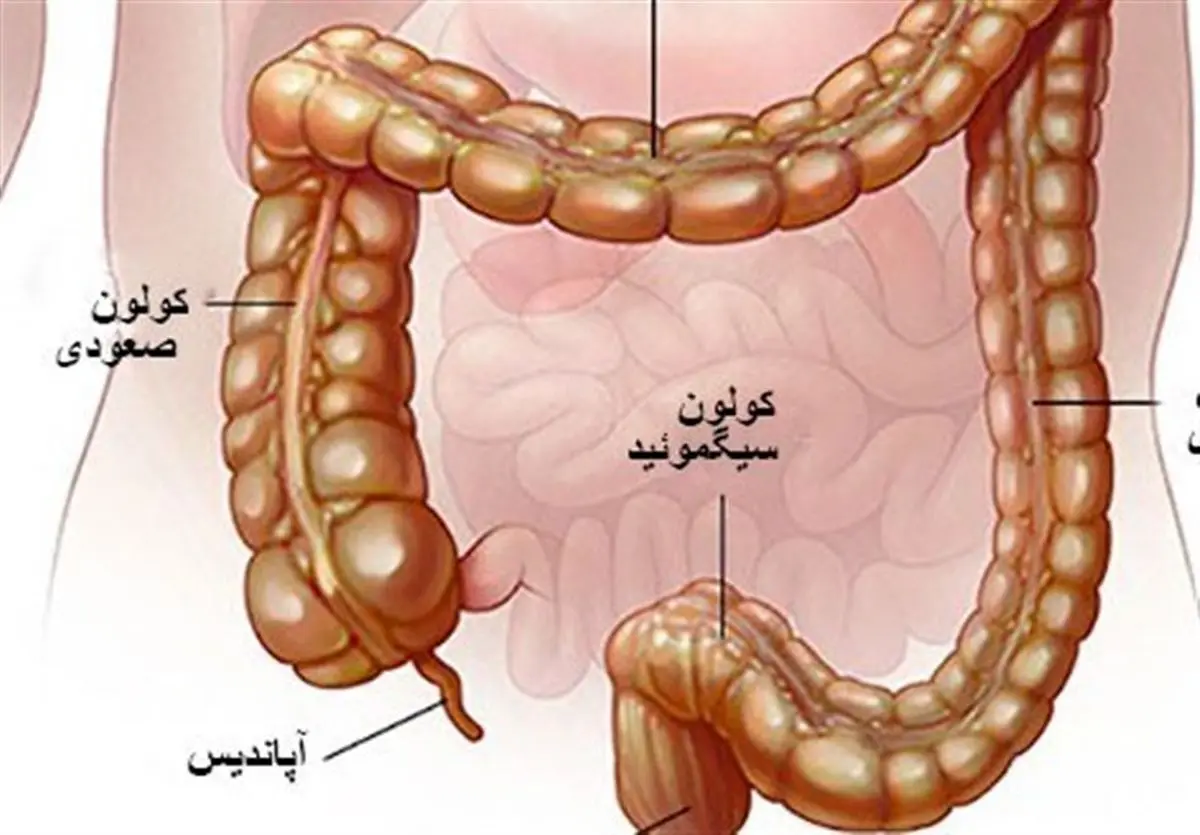  ۳ معجزه‌ گیاهی برای درمان «کولیت»