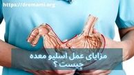 مزایای اسلیو معده چیست ؟