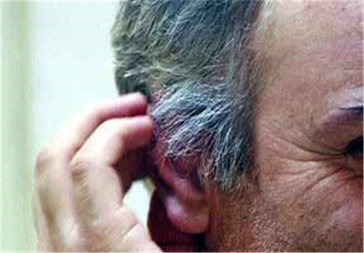 راه های جلوگیری از زود سفید شدن مو