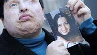  اسید پاشی بیشتر میتواند كار اينها باشد