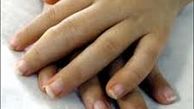 چرا انگشتان دست ورم می کند؟
