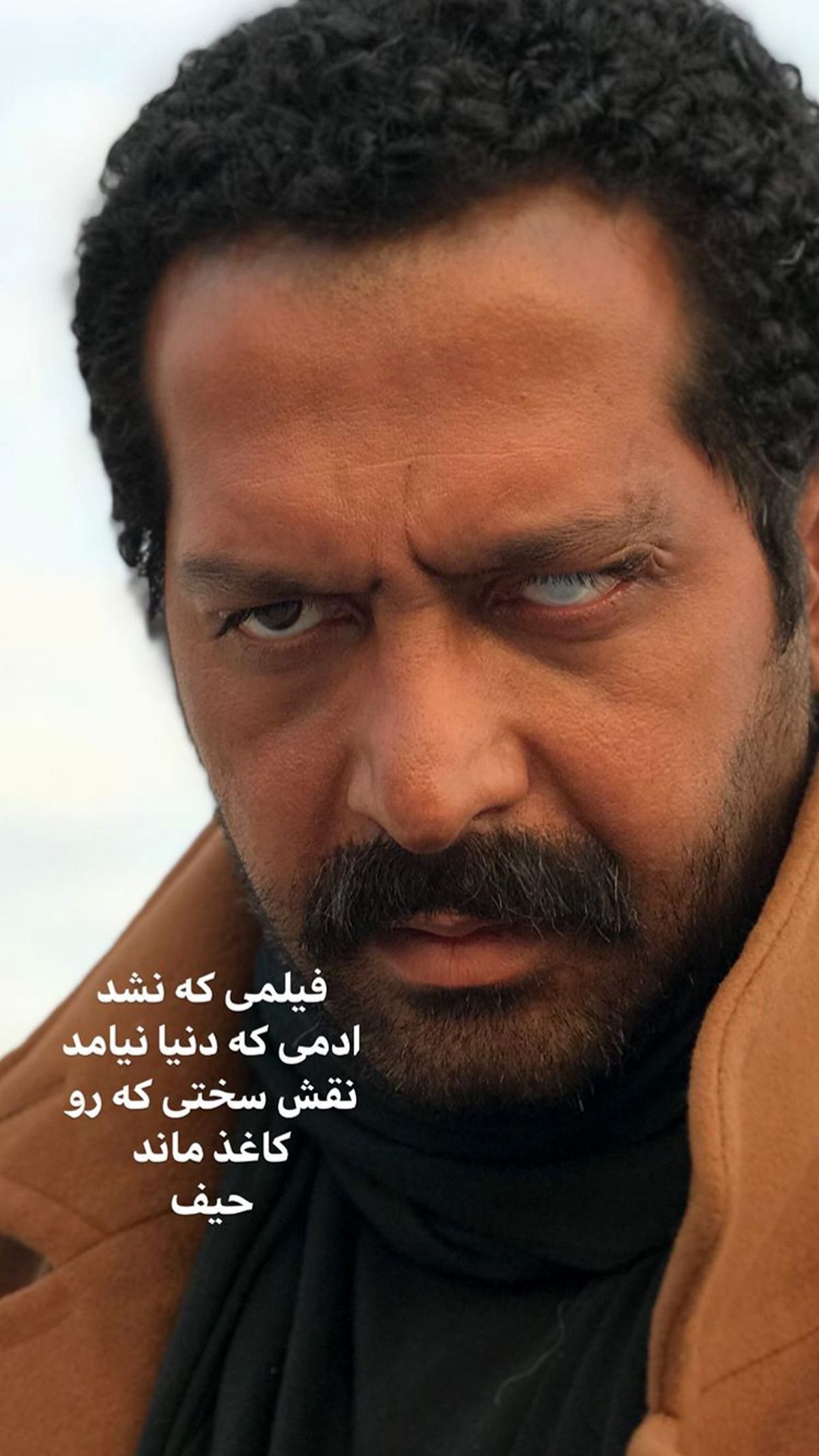 چشم نابینا شده کامران تفتی + عکس