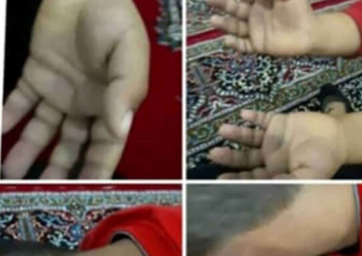 شکنجه دانش‌آموز کلاس اولی در یزد + چزئیات ماجرا