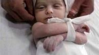 شهادت کودک هشت ماهه فلسطینی در نوار غزه/ عکس