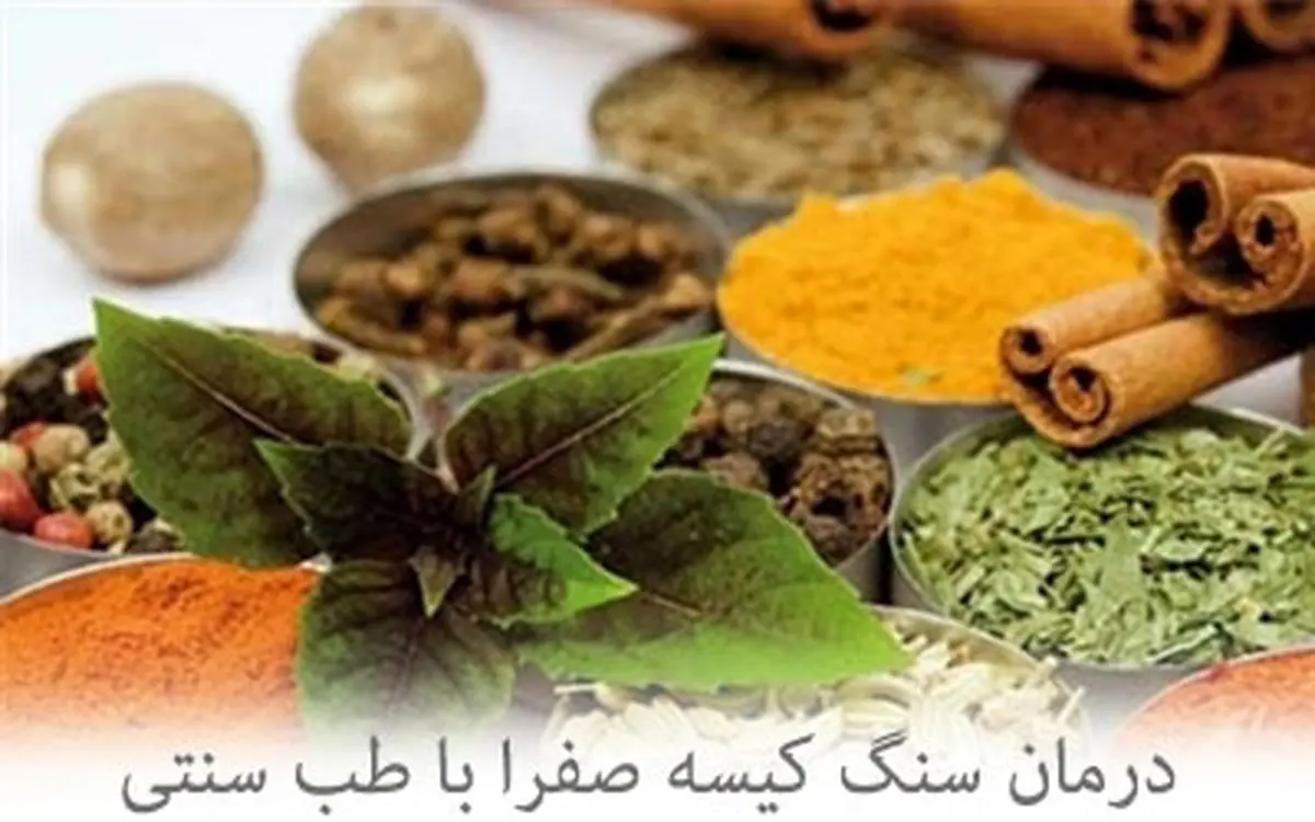  راه های دفع سنگ کیسه صفرا 