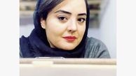چه چیزی در چهره نرگس محمدی تغییر کرده ؟ + عکس