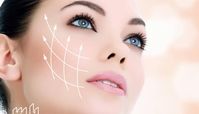 ایمپلنت گونه یا کاشت گونه چیست ؟