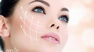 ایمپلنت گونه یا کاشت گونه چیست ؟