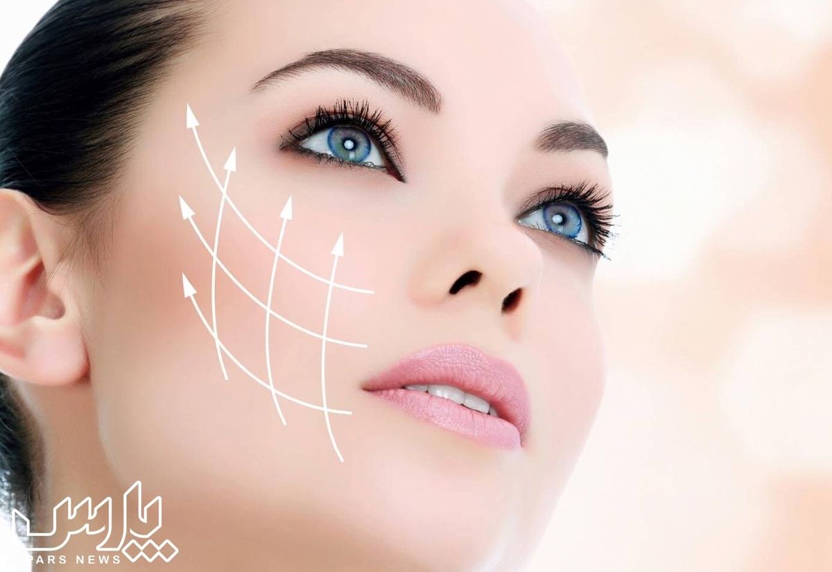 ایمپلنت گونه یا کاشت گونه چیست ؟