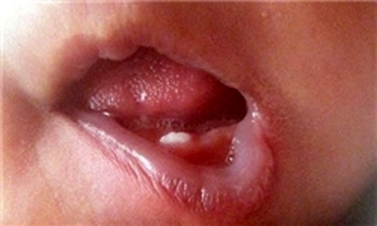 چه کسانی در 100 سالگی دندان در می‌آورند؟