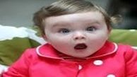 دختری که انگشتان دست و پایش هم‌اندازه‌اند!+ تصاویر