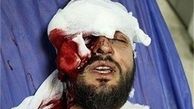 پزشکی قانونی نابینایی کامل چشم فروزش را تأیید کرد