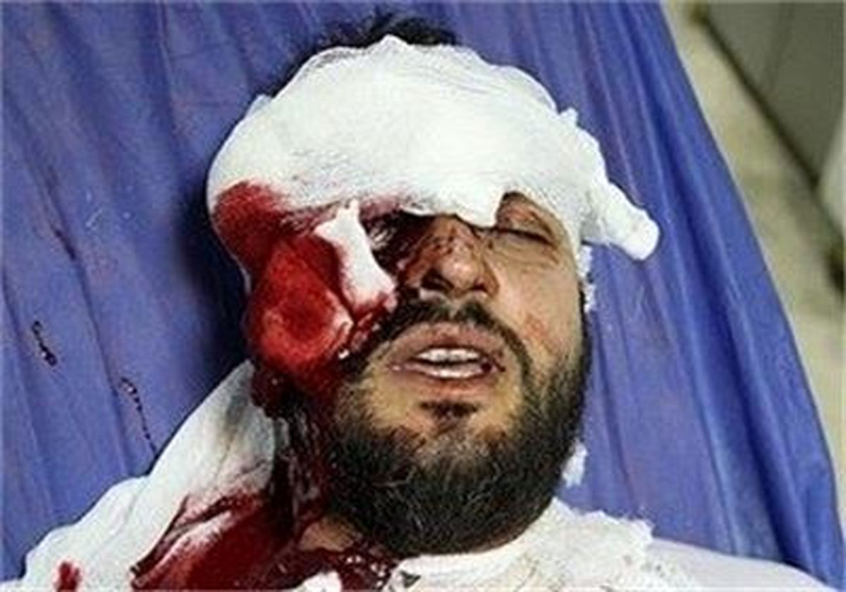 پزشکی قانونی نابینایی کامل چشم فروزش را تأیید کرد