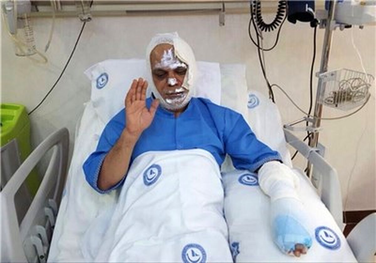 طلایی :در شعله‌های آتش سوختم/با سوختگی که داشتم بیمارستان آمبولانس نداد/ساخت مرکز تخصصی سوختگی
