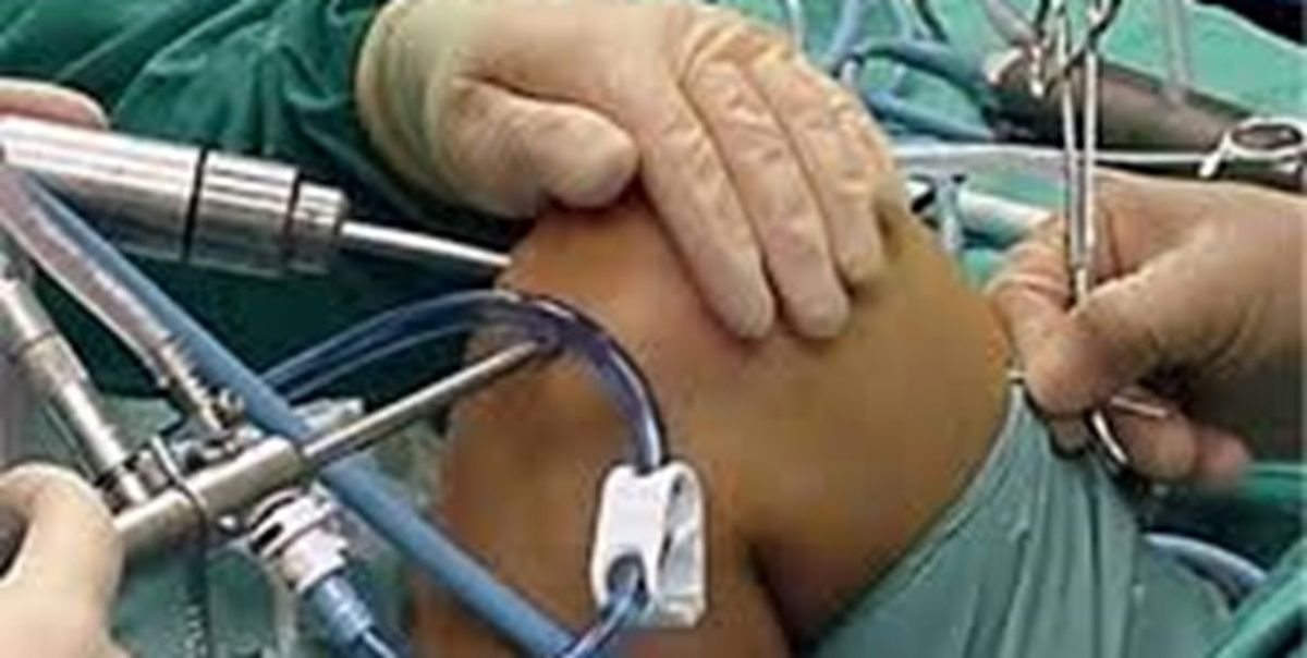 استفاده از دستاوردی جدید برای اعمال جراحی اصلاح استخوان