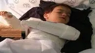 واکنش نظام پزشکی به جراحی اشتباه دست کودک 2 ساله