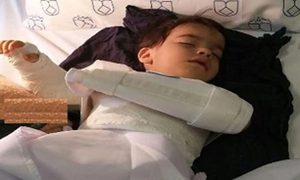 واکنش نظام پزشکی به جراحی اشتباه دست کودک 2 ساله