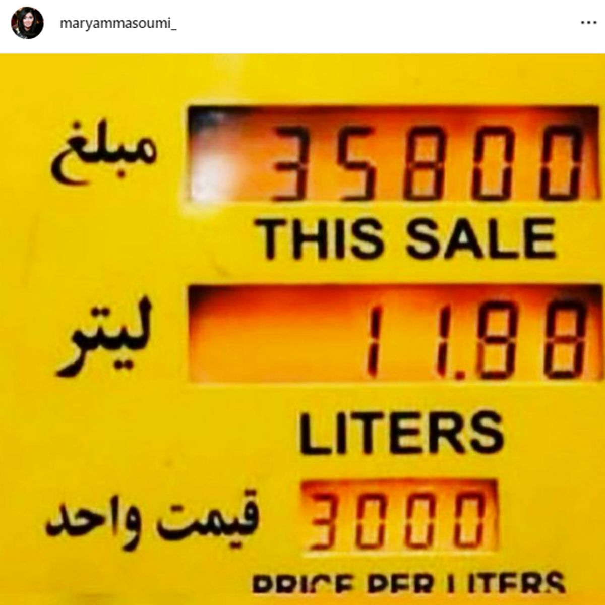 صورت کبود خانم بازیگر بعد از گرانی ها