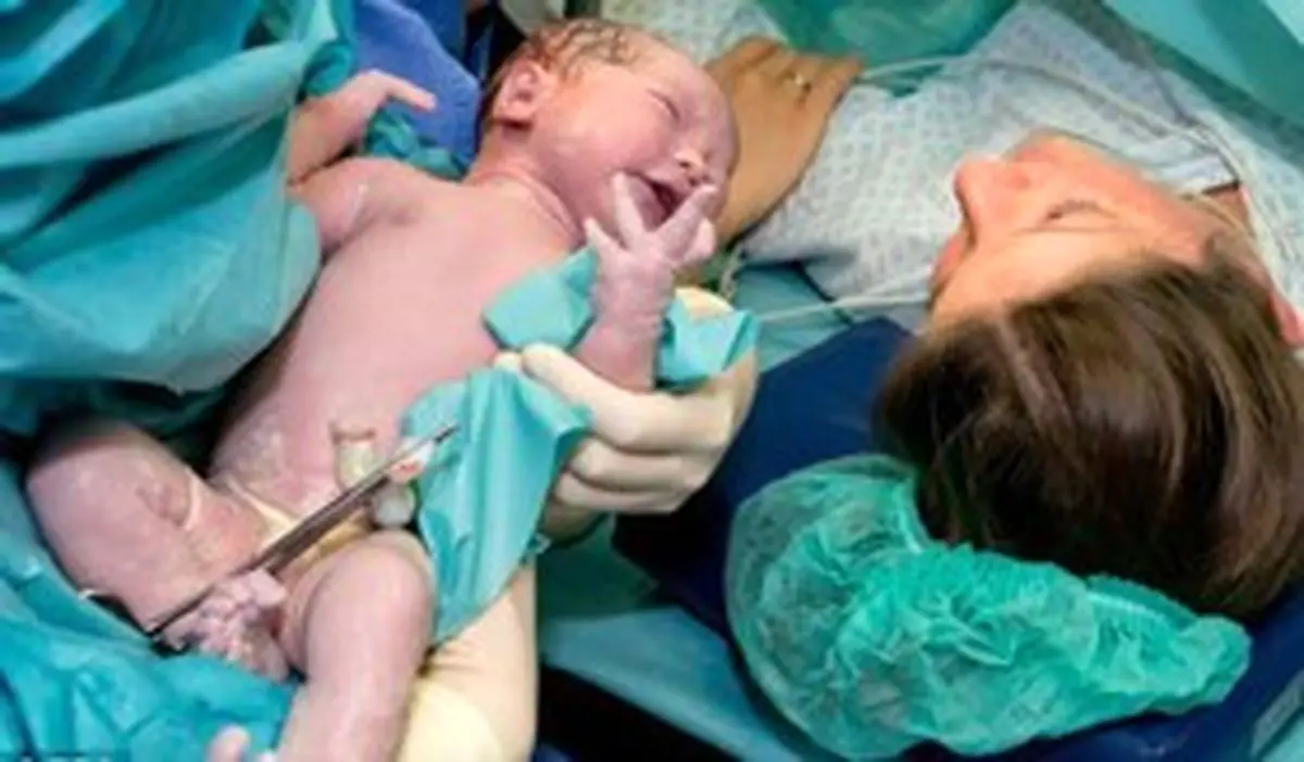 ۹۵ درصد حاملگی‌ها به سزارین ختم می‌شوند