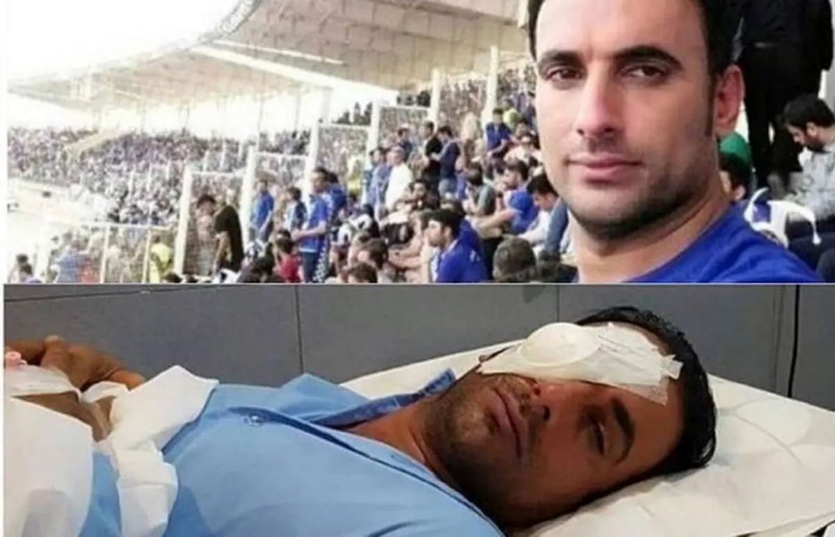 هوادار مصدوم آبی‌ها تماشاگر ویژه ذوب آهن - استقلال