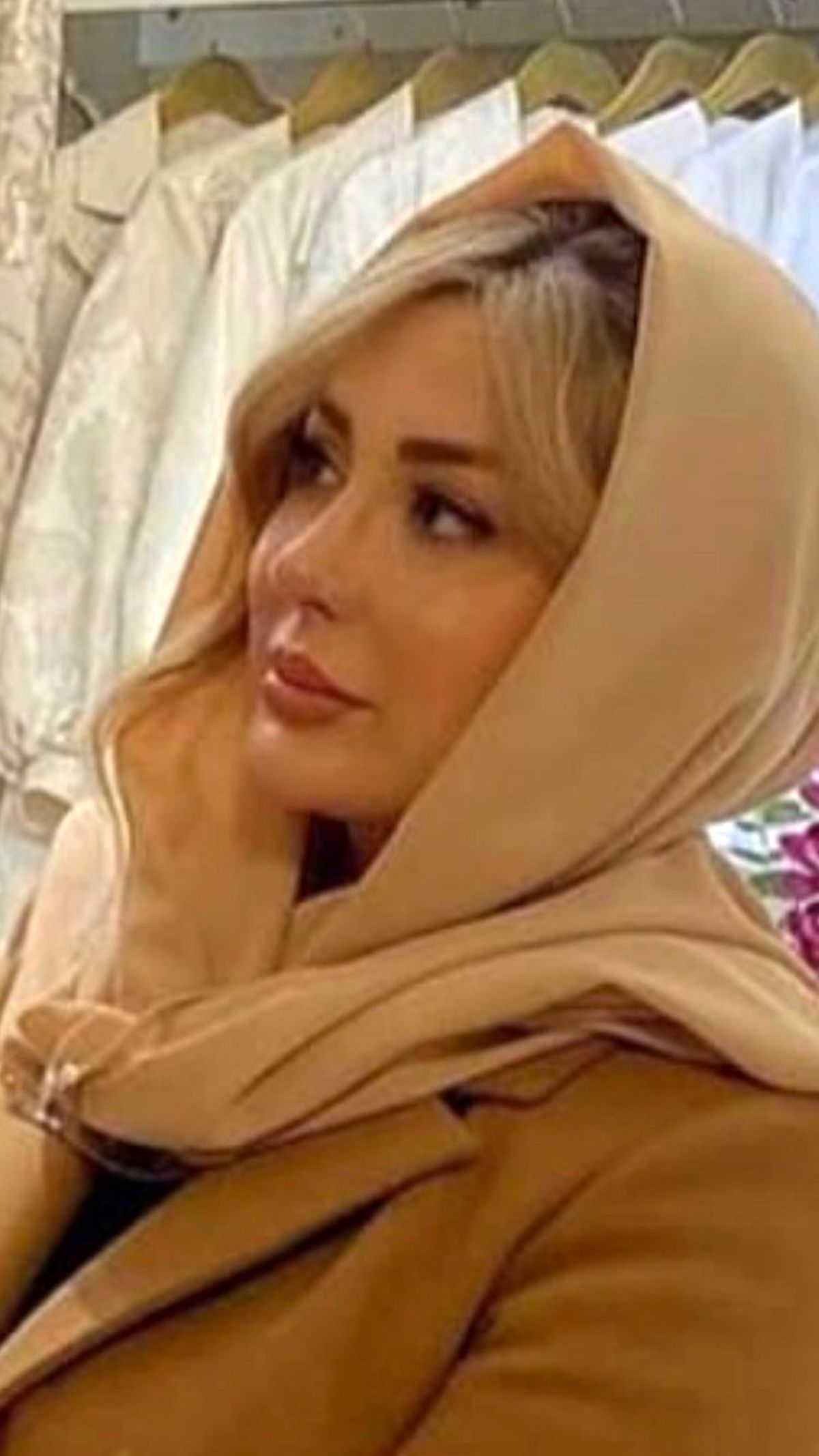 نیوشا ضیغمی پس از عمل دوم بینی اش + عکس