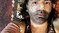 صورت بازیگر مشهور سوخت + عکس