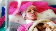 نتيجه يك پژوهش در مورد ميزان جراحي هاي زيبايي در ايران و آمريكا/ امكان پيوند صورت براي آسيب ديدگان اسيدپاشي