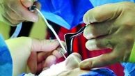 دغدغه جراحی زیبایی زنان حتی در شرایط کرونا
