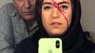 ستاره پسیانی با ظاهری زخمی و خون آلود+عکس
