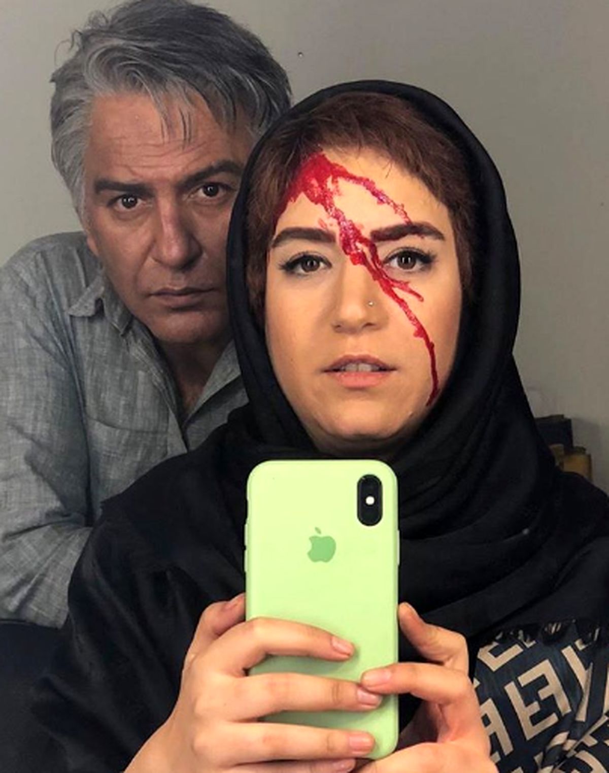 ستاره پسیانی با ظاهری زخمی و خون آلود+عکس
