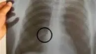 دندان و دنده را میشکنند دیه هم میگیرند