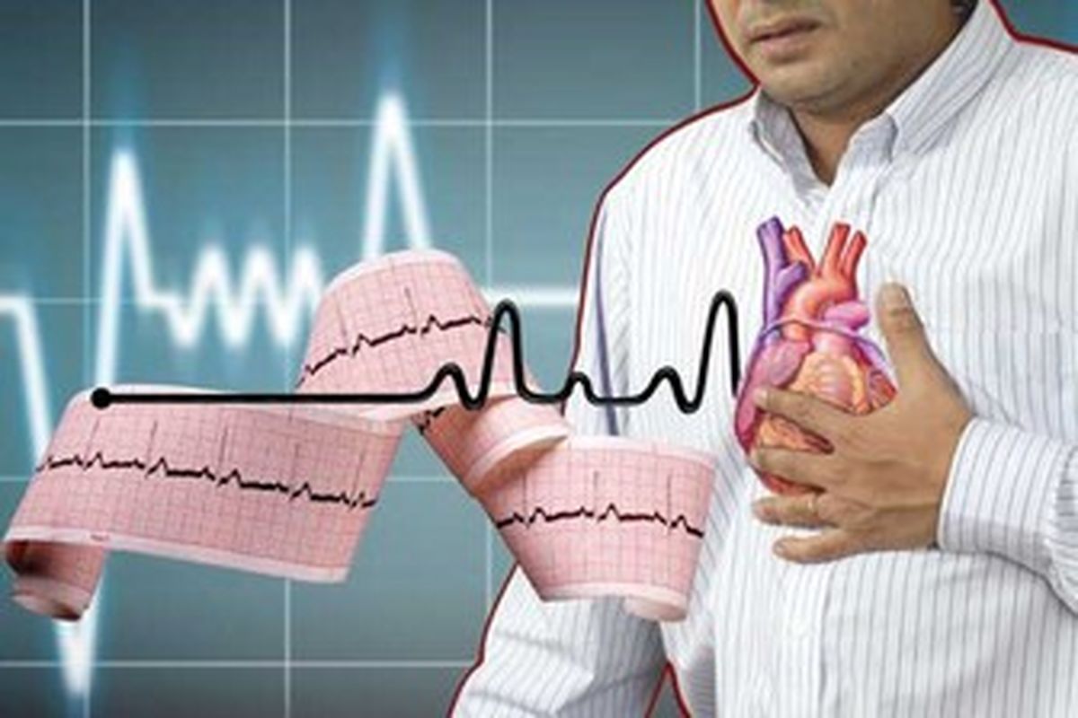 چرا صبح ها سکته می کنیم؟