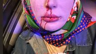 نیوشا ضیغمی با سری شکسته + عکس