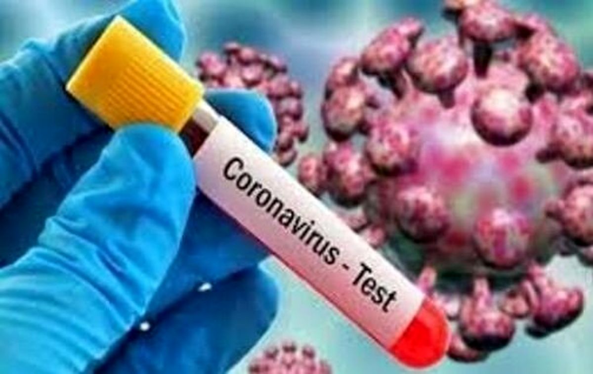 تولید داخلی ۳ نوع کیت تشخیص کرونا/تولید انبوه کیت تشخیص سریع، به زودی
