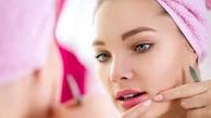 چه کار کنیم بعد اصلاح جوش نزنیم؟