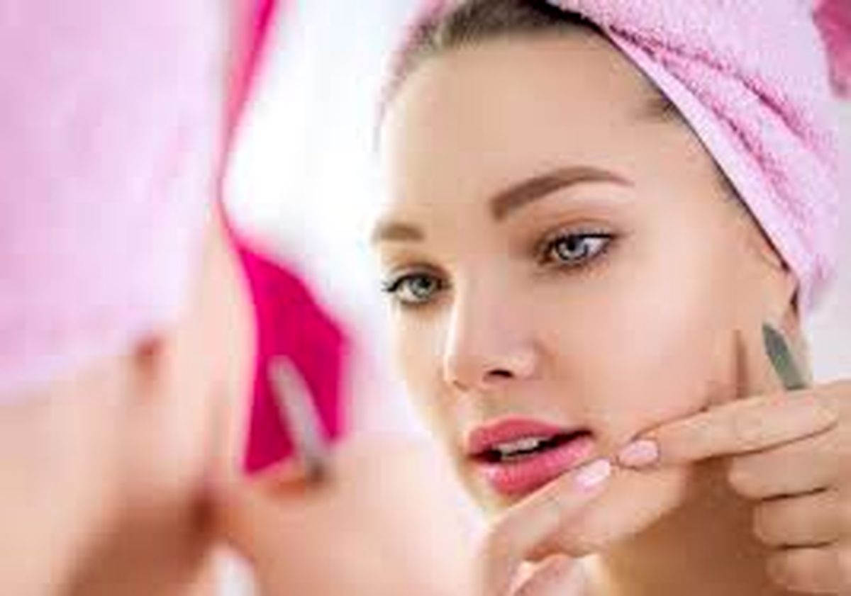 چه کار کنیم بعد اصلاح جوش نزنیم؟