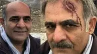 عکس آقای بازیگر با سر شکسته