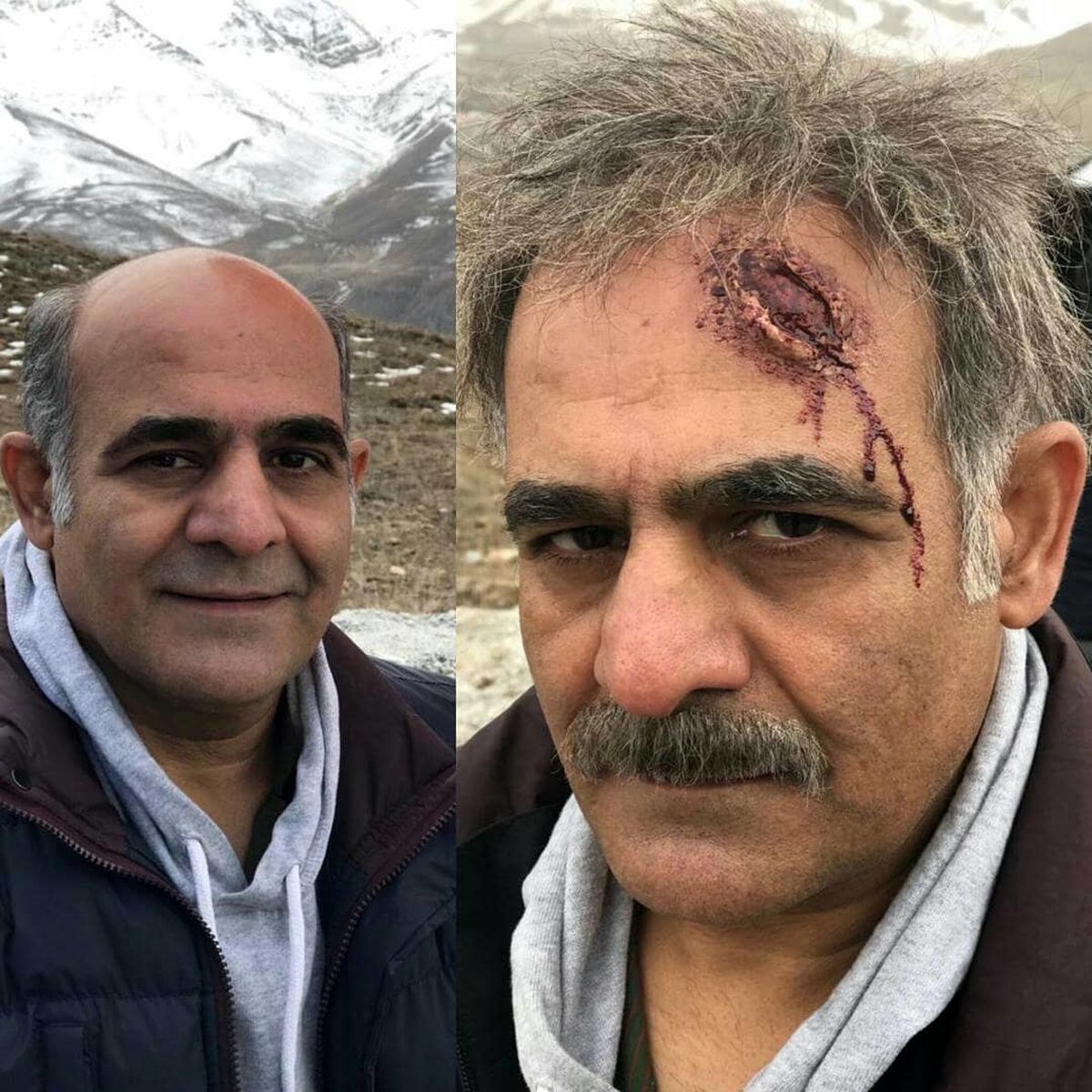 عکس آقای بازیگر با سر شکسته