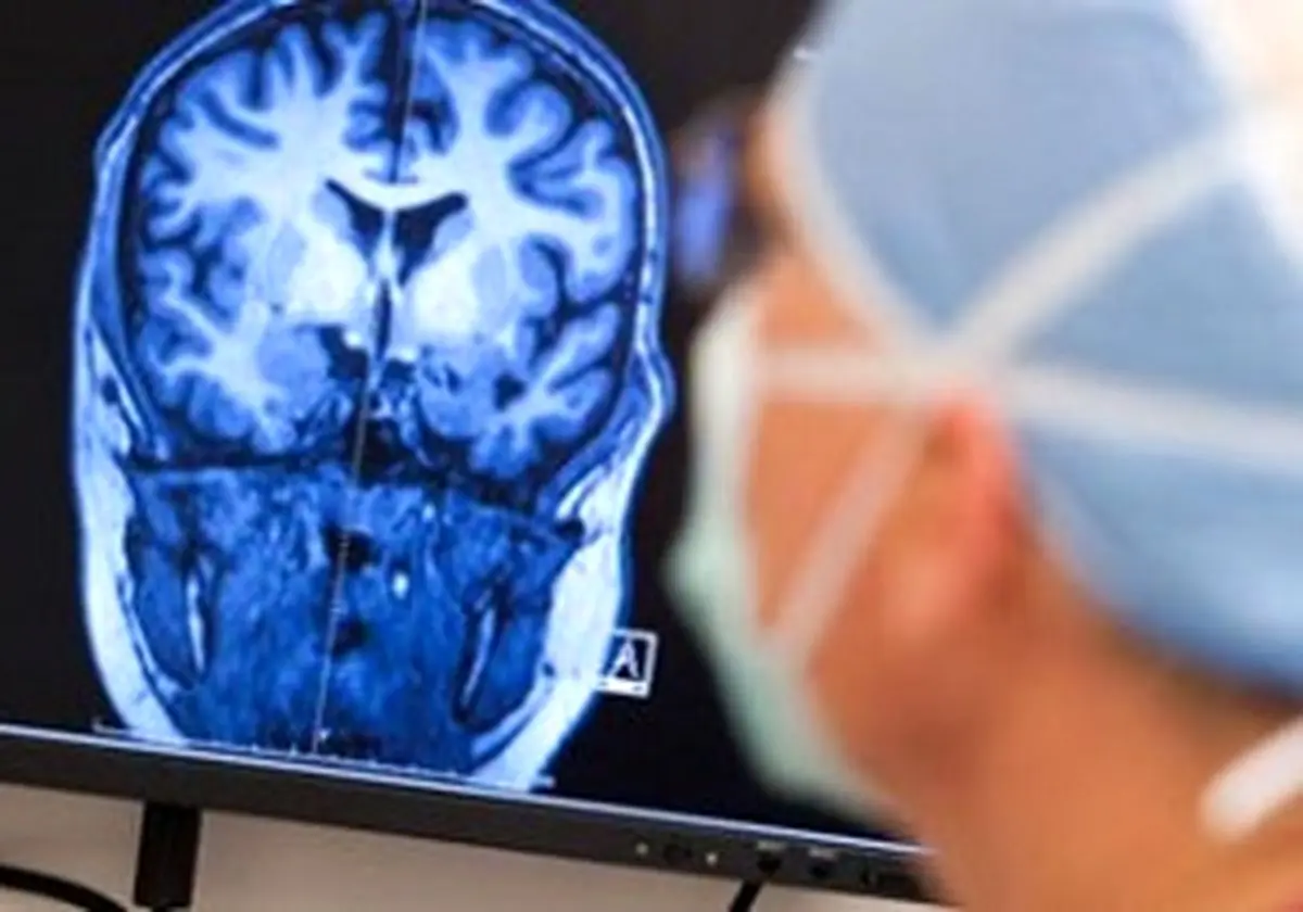 این مواد غذایی برای بیماران صرعی سم است 