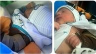 شکستگی بازوی نوزاد اصفهانی در حین عمل زایمان +عکس