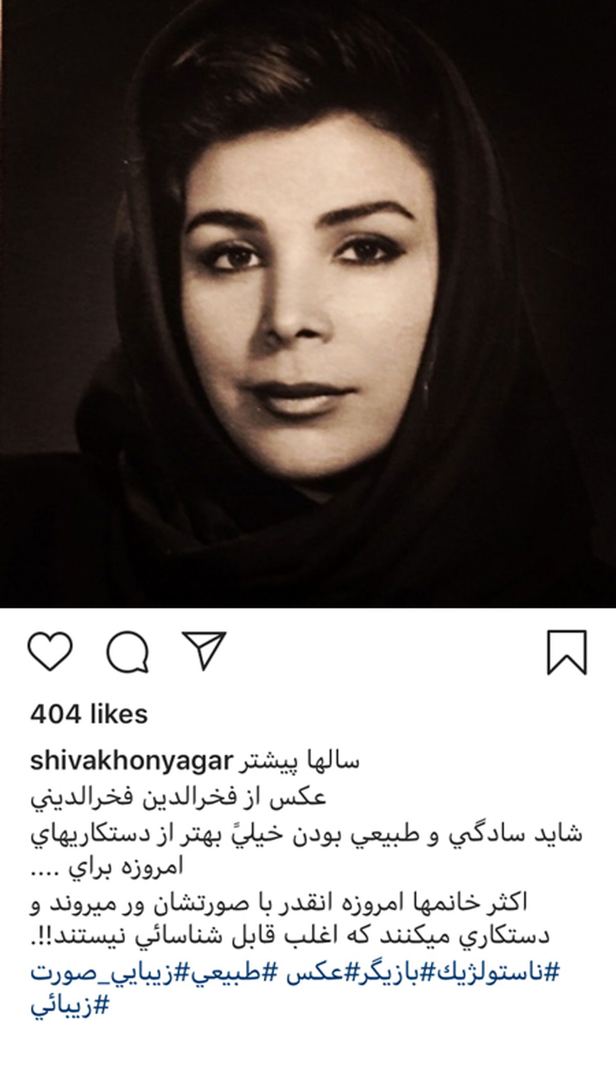 شیوا خنیاگر بدون عمل زیبایی + عکس