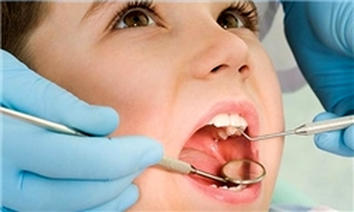 پس از عصب کشی چه باید کرد؟